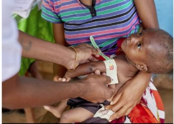 Impact Du Cyclone Freddy : 115.000 Enfants Victimes De Malnutrition Aiguë
