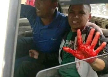 Madagascar en proie à la violence : Les forces de l’ordre utilisées comme instruments de répression